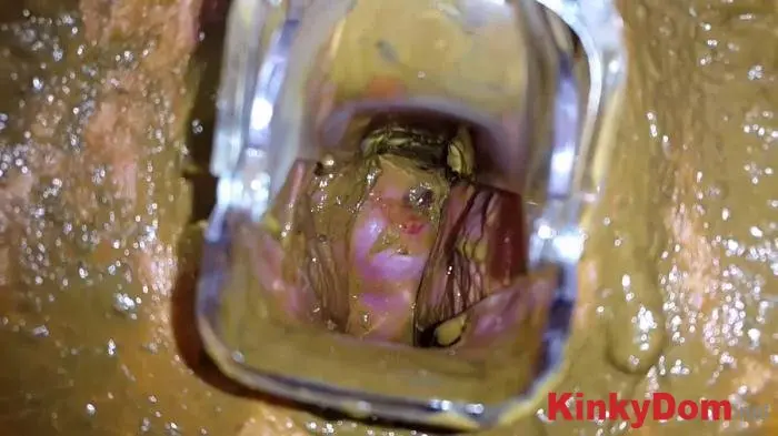 Anna Coprofield (Tampon, Speculum Filled Pussy Part 2 - FullHD 1080p) [mp4 / 1.60 GB] - Scat Download
