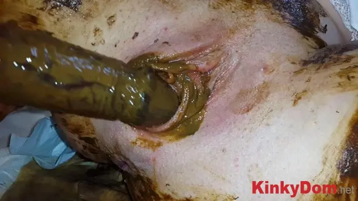Anna Coprofield (Gynecological Self-Examination Shit - Filled Pussy Thought The Speculum - FullHD 1080p) [mp4 / 2.99 GB] - Scat Download