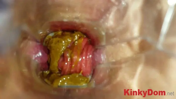 Anna Coprofield (Speculum Play and Filled Pussy part 1 - FullHD 1080p) [mp4 / 1.23 GB] - Scat Download