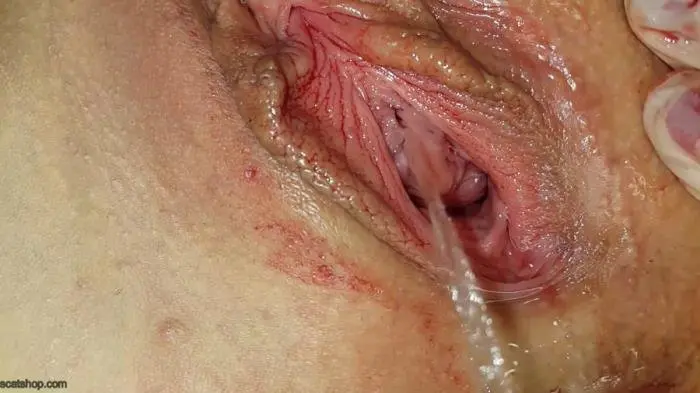 Anna Coprofield (Shit and Blood Vol.8 Speculum - FullHD 1080p) [mp4 / 3.88 GB]