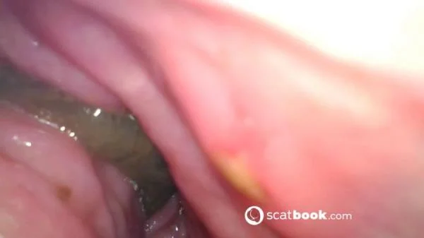 Endoscope In My Ass - FullHD 1080p [mp4 / 647 MB] - Scat Download