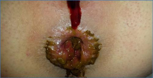 💩 Watch Anna Coprofield Shit Clip- Quickly Shit In The Morning - Scat Download