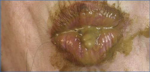 Dirtygardengirl Delivers Extreme Copro and Fisting video - Scat Download