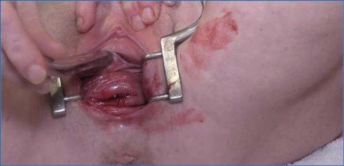 Dirtygardengirl Explores Period Play, Peehole Insertion, and Hardcore Scat in Solo clip - Scat Download