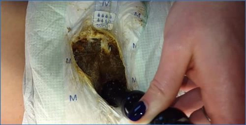 Anna Coprofield's Prolapse Farting & Pooping Bonanza on the Toilet - Scat Download