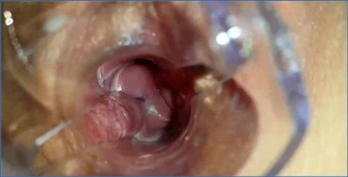 Anna Coprofield Prolapse Scat Porn - Polish Star Shits and Streams - Scat Download