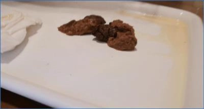 Badkitty España in a Filthy Shitting and Scat video with Vomit and Piss - Scat Download